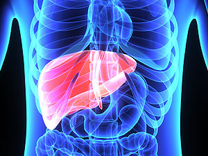 Y90 Radioembolization for Liver Tumors