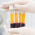 Nassau County, Mount Sinai South Nassau To Offer COVID-19 Viral & Antibody Testing in Long Beach